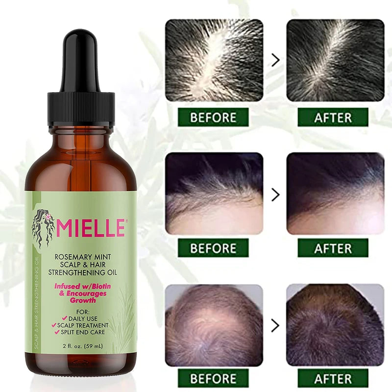 Rosemary Hair & Scalp OilRosemary Hair & Scalp Oil
