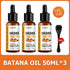 Lewedo Naturals Batana Oil Fast Hair Growth Oil for Men Women