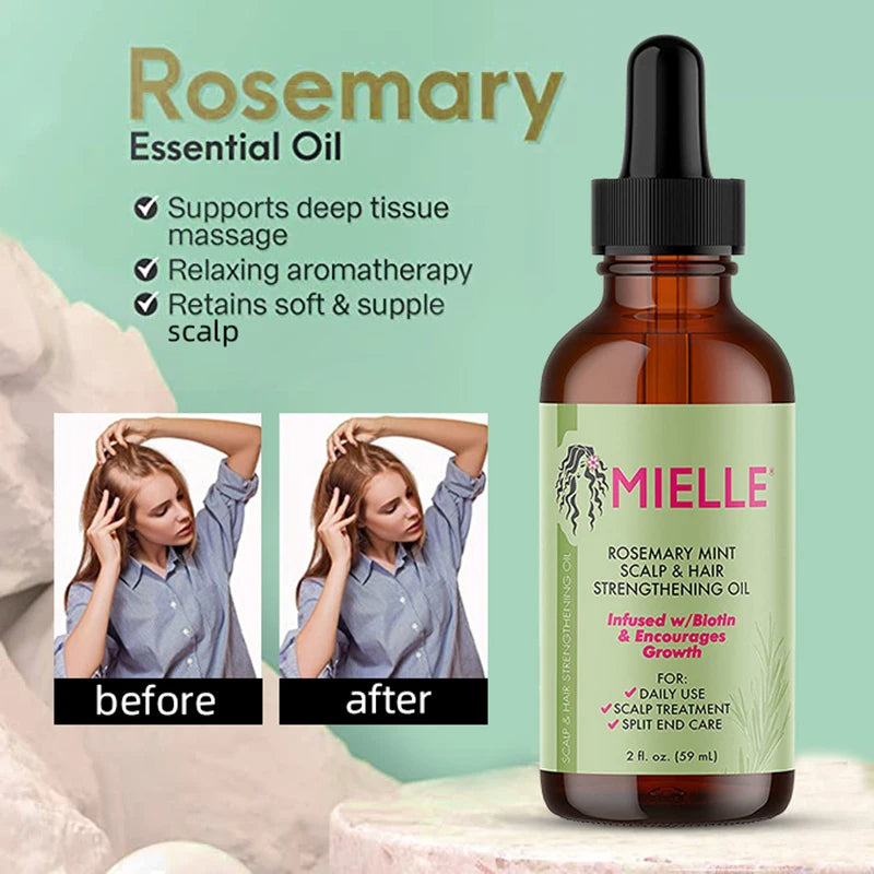 Rosemary Hair &amp; Scalp OilRosemary Hair &amp; Scalp Oil