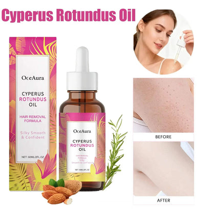Cyperus Rotundus Oil for Hair Removal